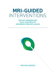 MRI-guided interventions for fast diagnosis and focal treatment of (recurrent) prostate cancer