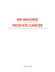 MR imaging in localizing prostate cancer (recurrence) and guiding interventions