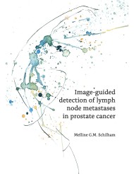 Image-guided detection of lymph node metastases in prostate cancer