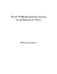 1H and 31P MR Spectroscopic Imaging of the prostate at 7 Tesla