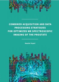Combined acquisition and data processing strategies for optimized MR spectroscopic imaging of the prostate