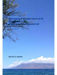 MR Imaging of prostate cancer at 3T: the pros and cons of scanning with endorectal coil