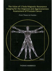 The value of 3 tesla magnetic resonance imaging for the detection and aggressivenes assessment of prostate cancer - from theory to practice