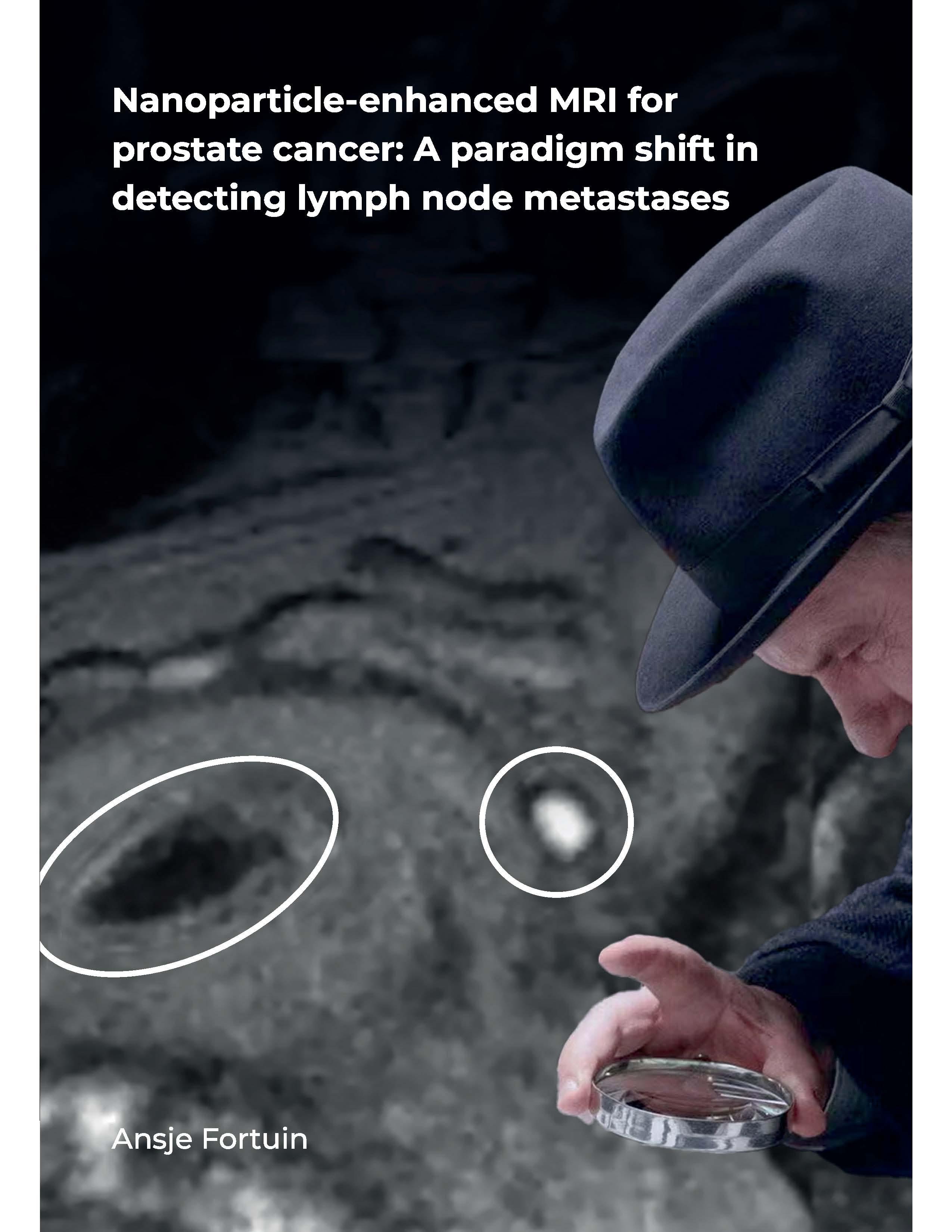 Defense Ansje Fortuin